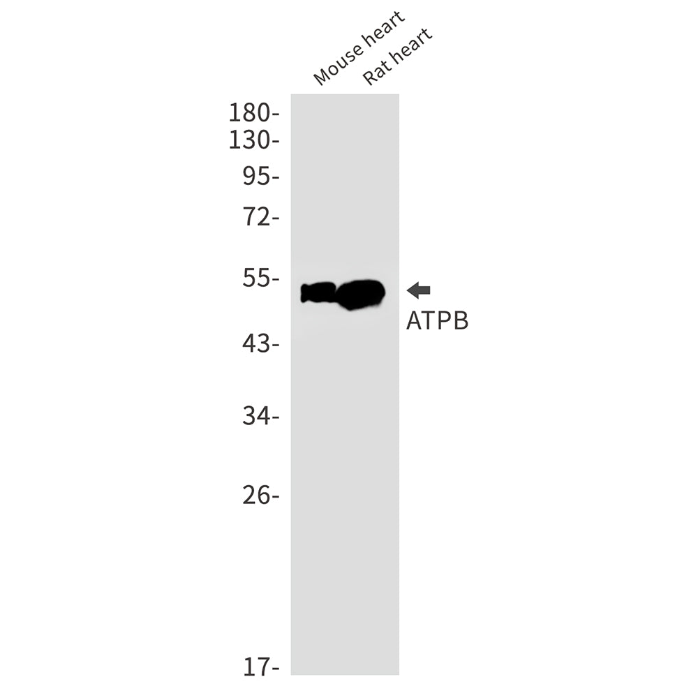 Anti-ATPB Rabbit Monoclonal Antibody