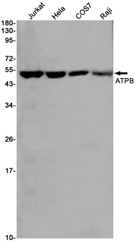 Anti-ATPB Rabbit Monoclonal Antibody