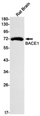 Anti-BACE1 Rabbit Monoclonal Antibody