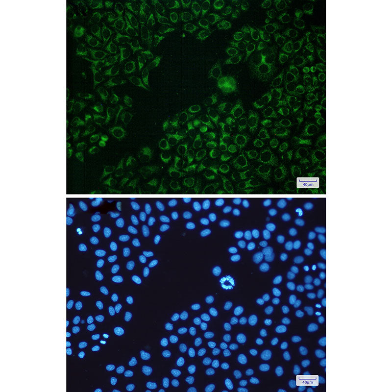 Anti-Bad Rabbit Monoclonal Antibody