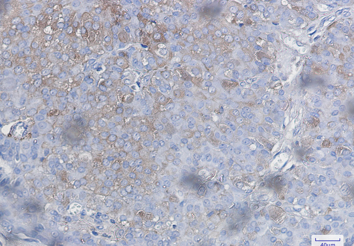Anti-Bad Rabbit Monoclonal Antibody