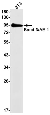 Anti-Band 3 Rabbit Monoclonal Antibody
