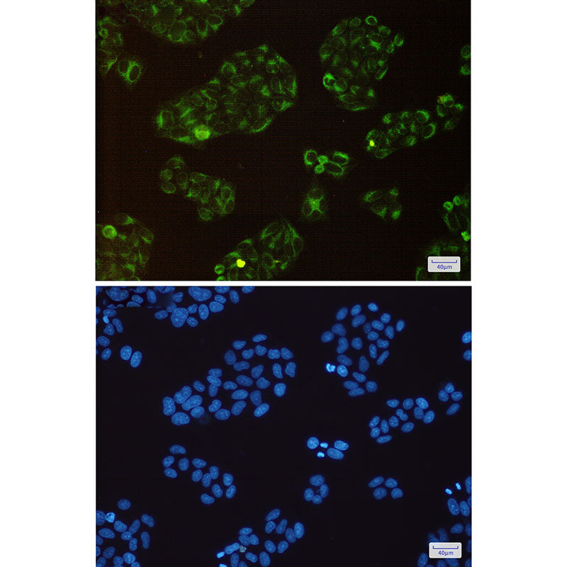 Anti-BAP31 Rabbit Monoclonal Antibody