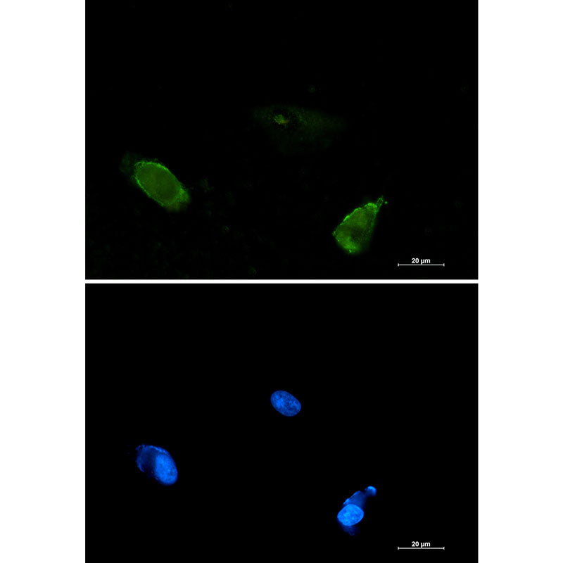 Anti-BIN1 Rabbit Monoclonal Antibody