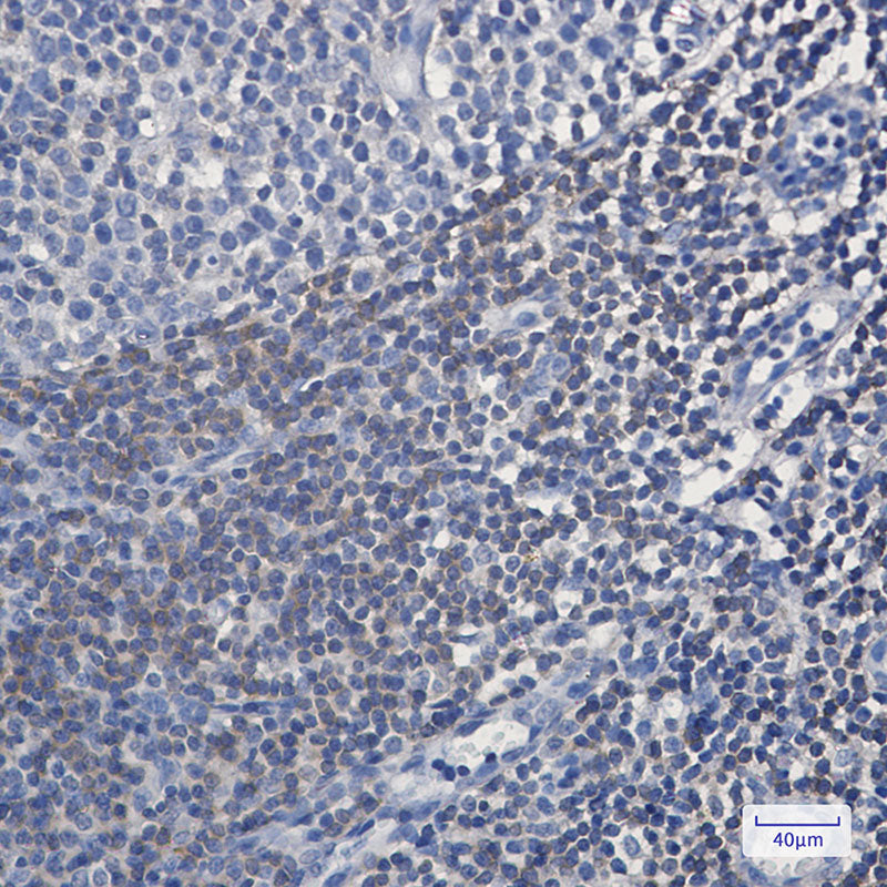 Anti-BIN1 Rabbit Monoclonal Antibody