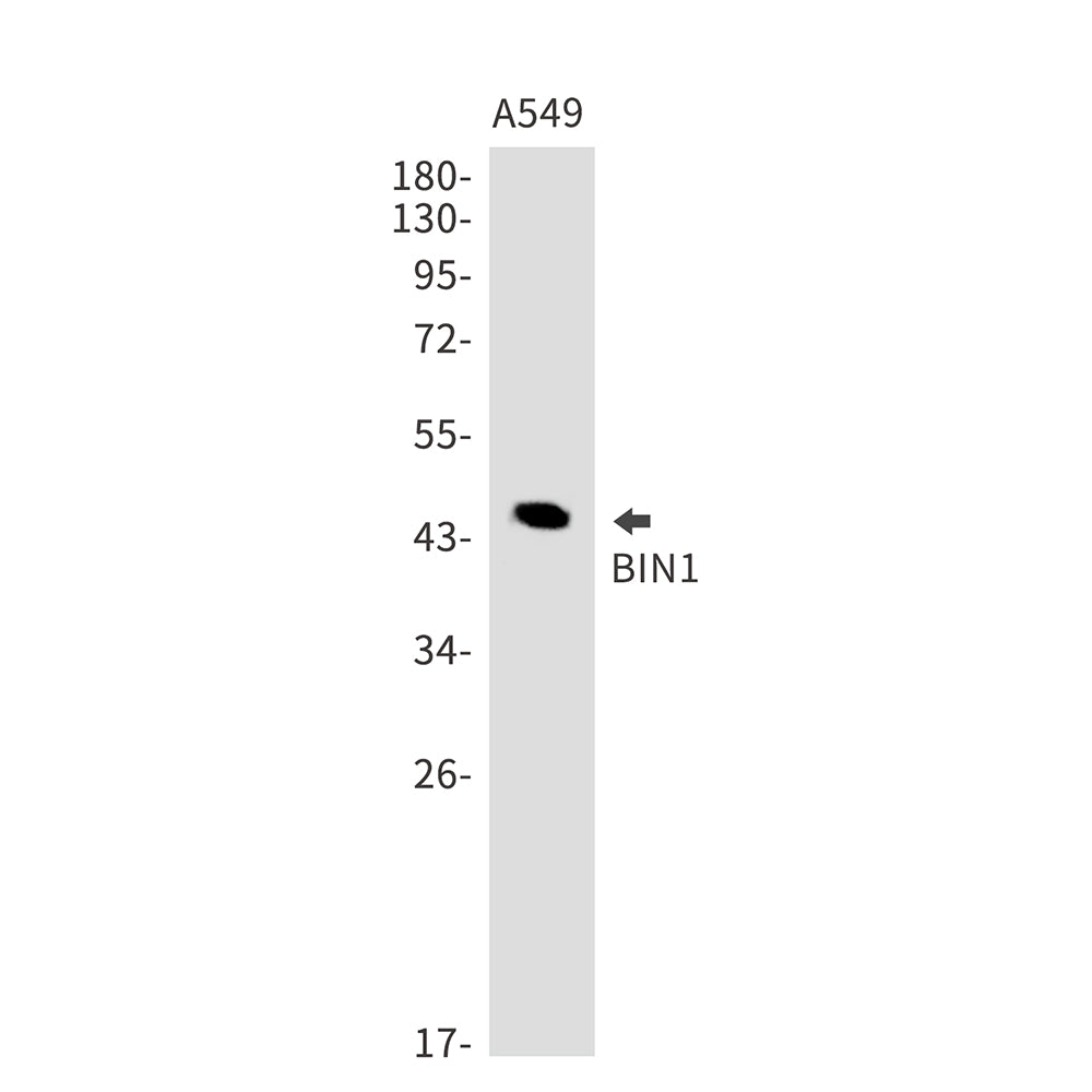 Anti-BIN1 Rabbit Monoclonal Antibody