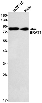 Anti-BRAT1 Rabbit Monoclonal Antibody
