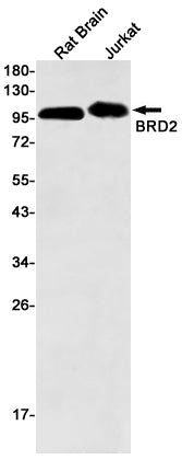 Anti-BRD2 Rabbit Monoclonal Antibody