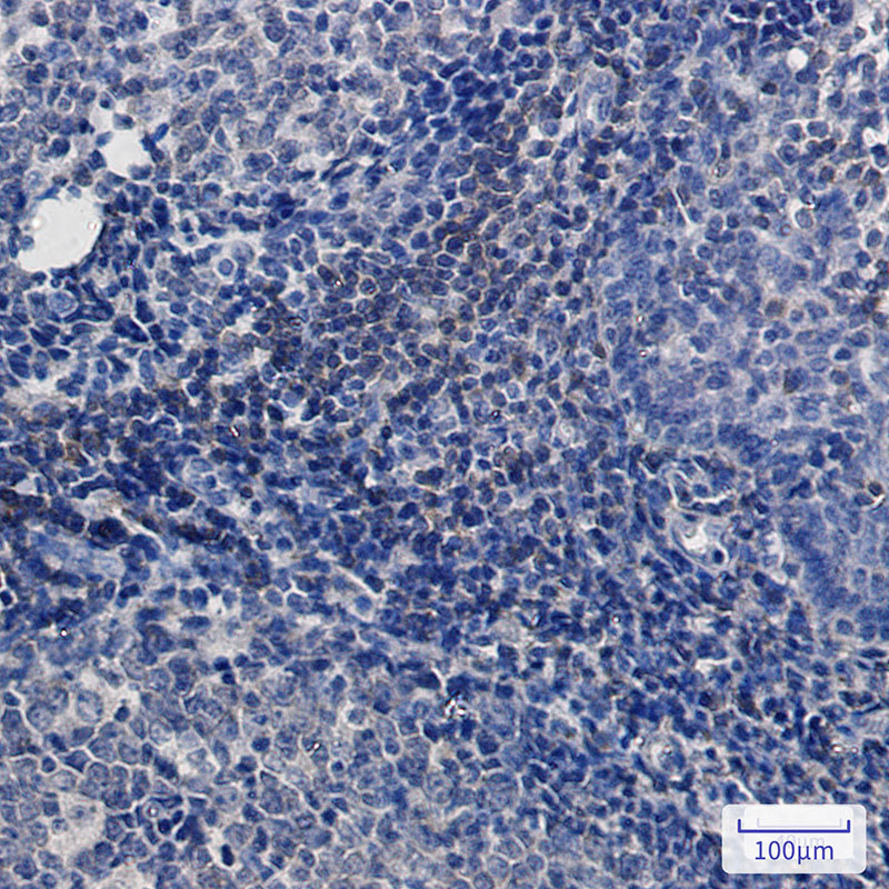 Anti-BTK Rabbit Monoclonal Antibody