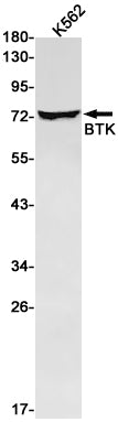 Anti-BTK Rabbit Monoclonal Antibody