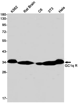 Anti-GC1q R Rabbit Monoclonal Antibody