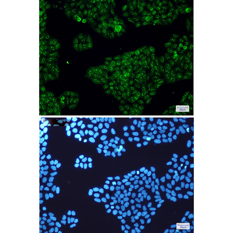 Anti-Calretinin Rabbit Monoclonal Antibody