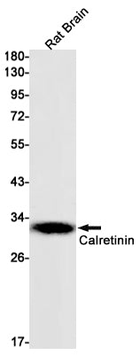 Anti-Calretinin Rabbit Monoclonal Antibody