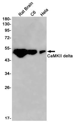 Anti-CaMKII delta Rabbit Monoclonal Antibody