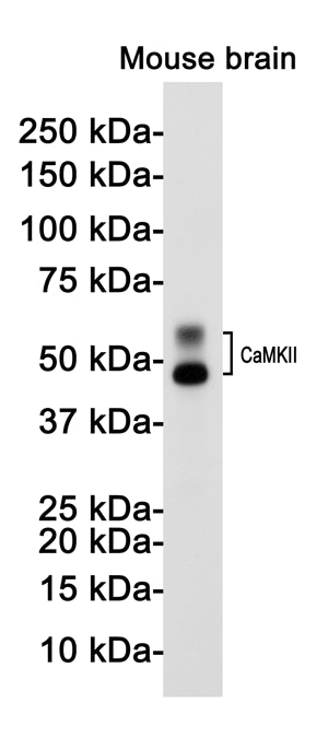 Anti-CaMKII beta Rabbit Monoclonal Antibody