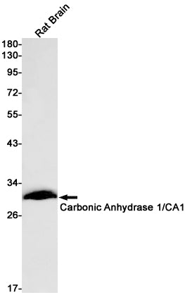 Anti-Carbonic Anhydrase 1 Rabbit Monoclonal Antibody