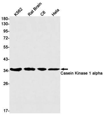 Anti-Casein Kinase 1 alpha Rabbit Monoclonal Antibody