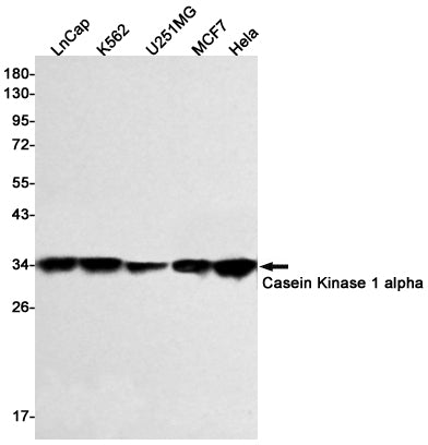 Anti-Casein Kinase 1 alpha Rabbit Monoclonal Antibody