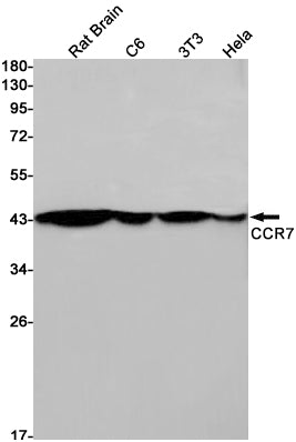 Anti-CCR7 Rabbit Monoclonal Antibody