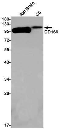Anti-CD166 Rabbit Monoclonal Antibody