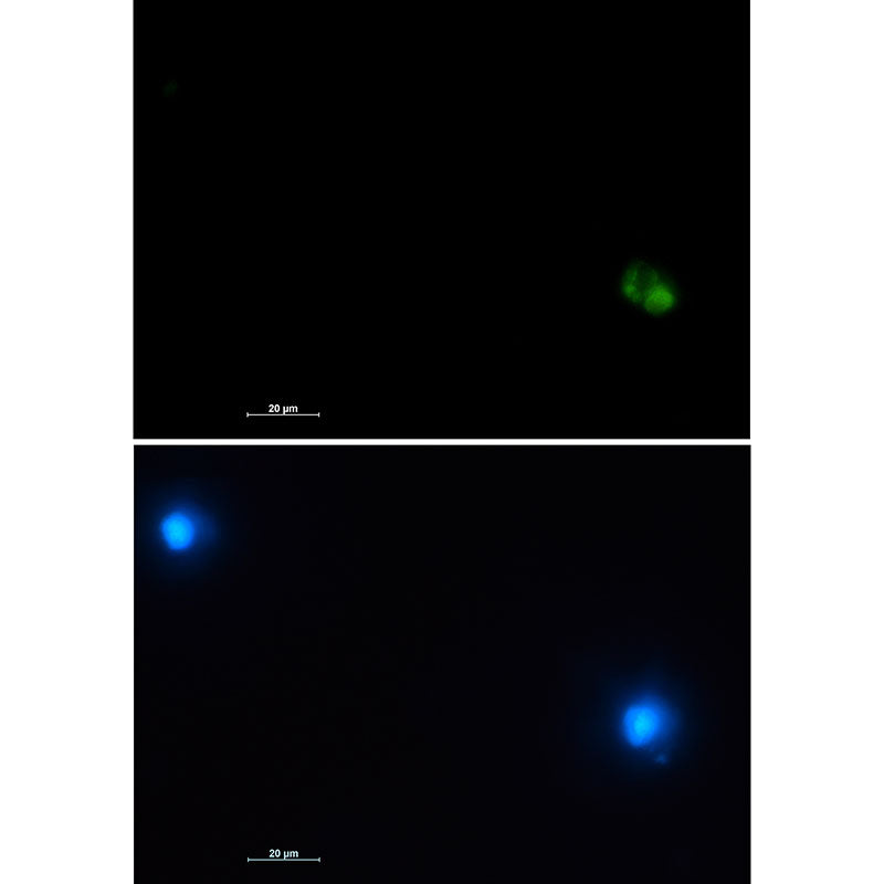 Anti-CD22 Rabbit Monoclonal Antibody