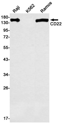 Anti-CD22 Rabbit Monoclonal Antibody
