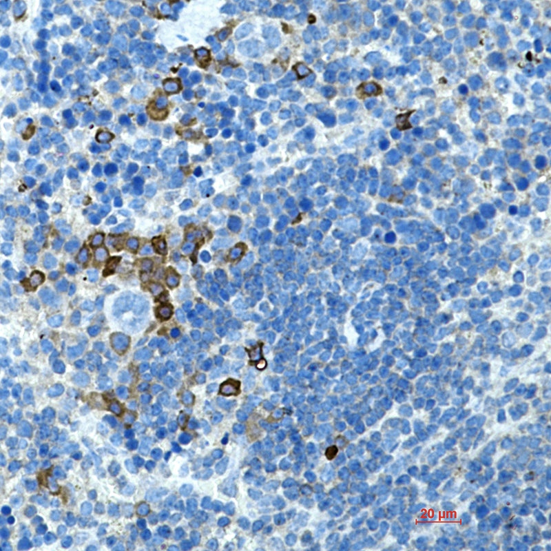 Anti-CD272 Rabbit Monoclonal Antibody