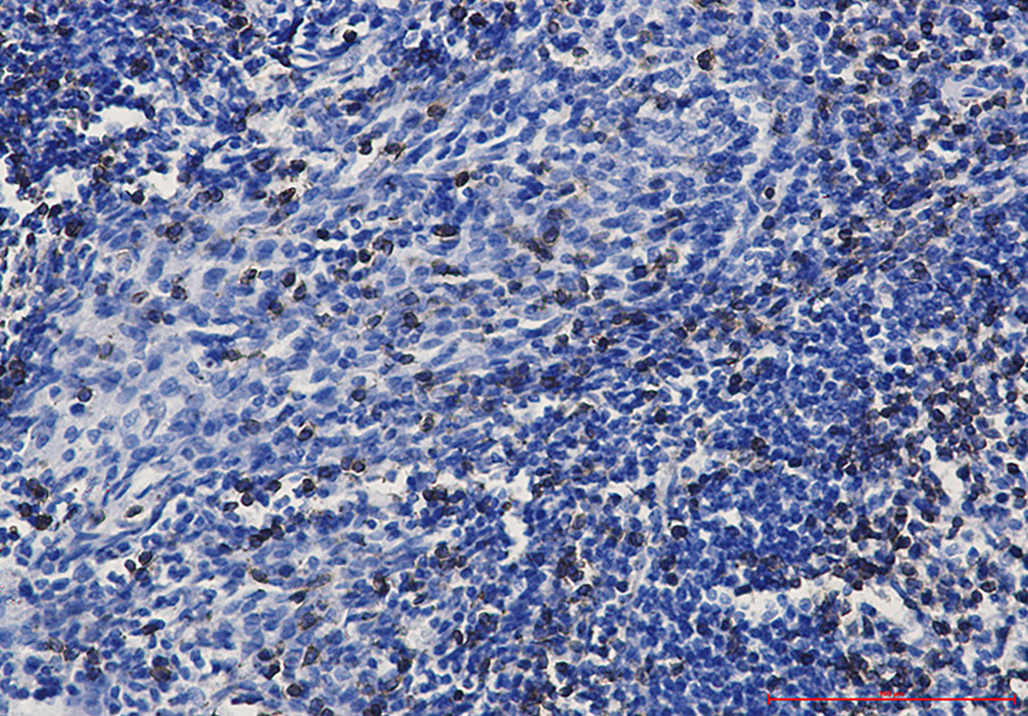 Anti-CD3 epsilon Rabbit Monoclonal Antibody