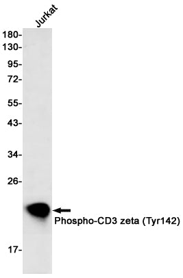Anti-Phospho-CD3 zeta (Tyr142) Rabbit Monoclonal Antibody