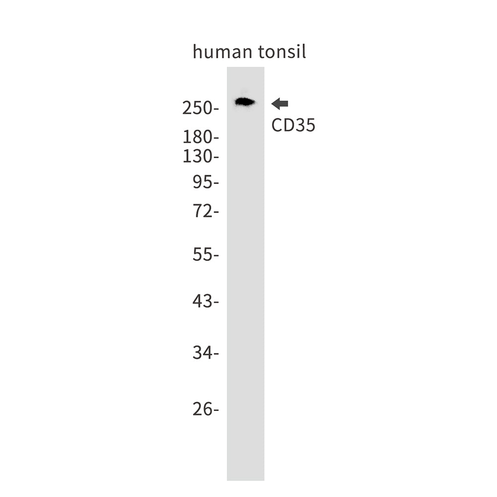 Anti-CD35 Rabbit Monoclonal Antibody