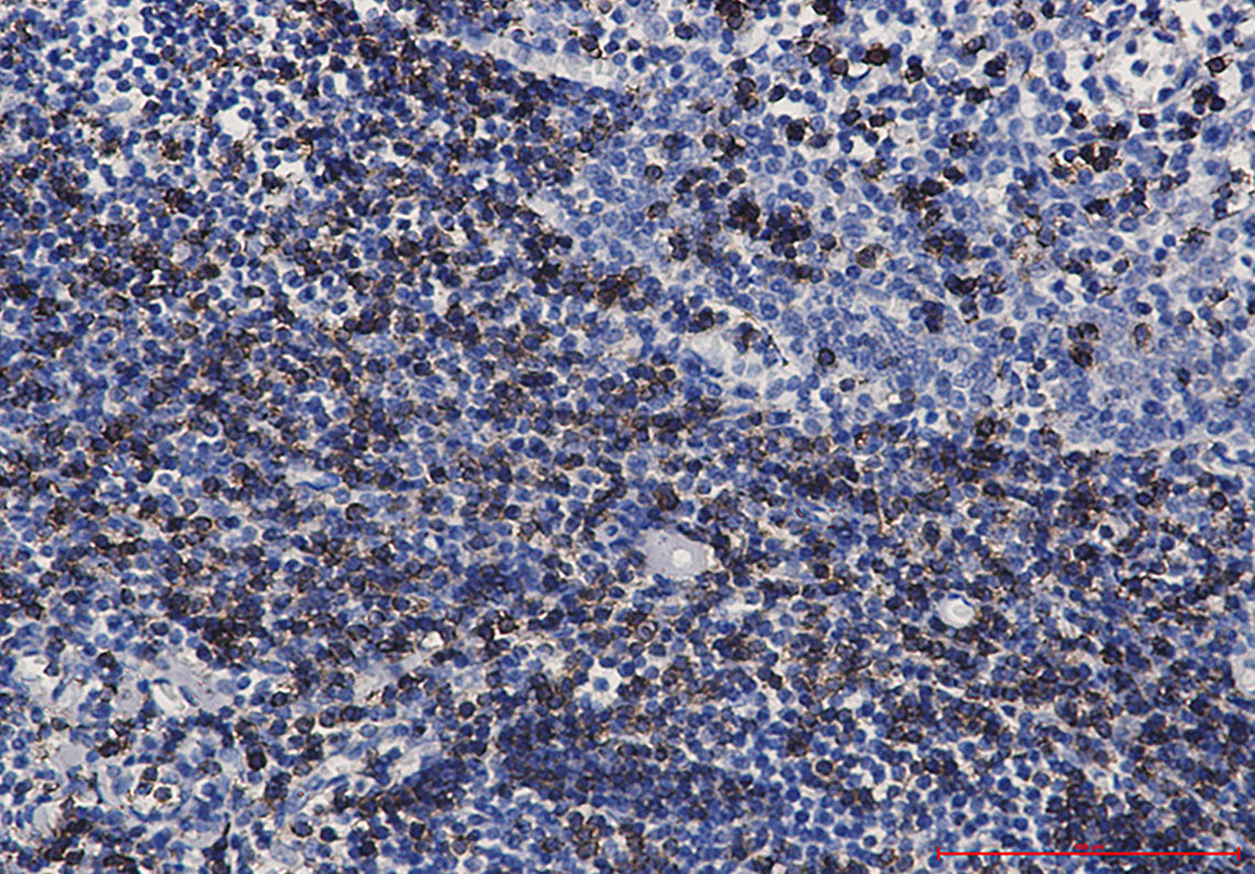 Anti-CD7 Rabbit Monoclonal Antibody