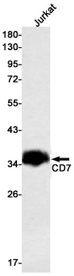 Anti-CD7 Rabbit Monoclonal Antibody