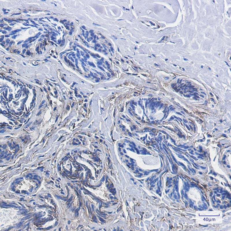 Anti-CD99 Rabbit Monoclonal Antibody