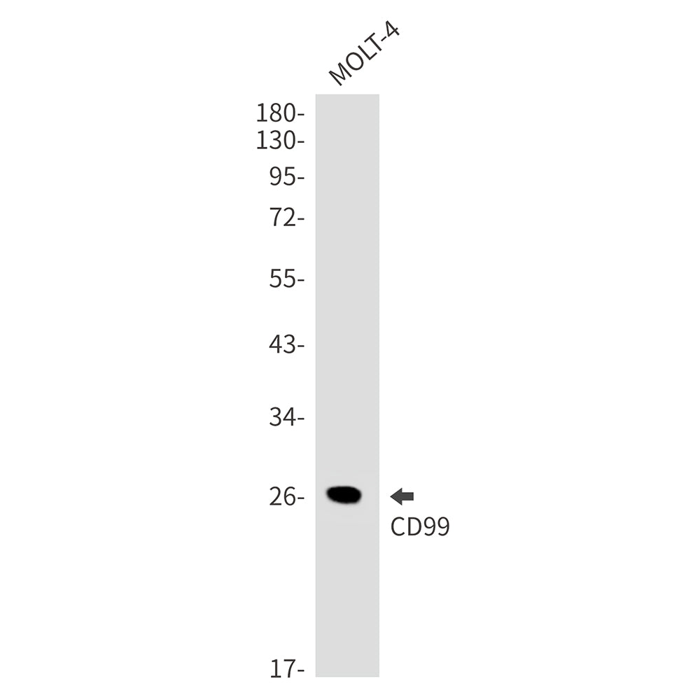 Anti-CD99 Rabbit Monoclonal Antibody