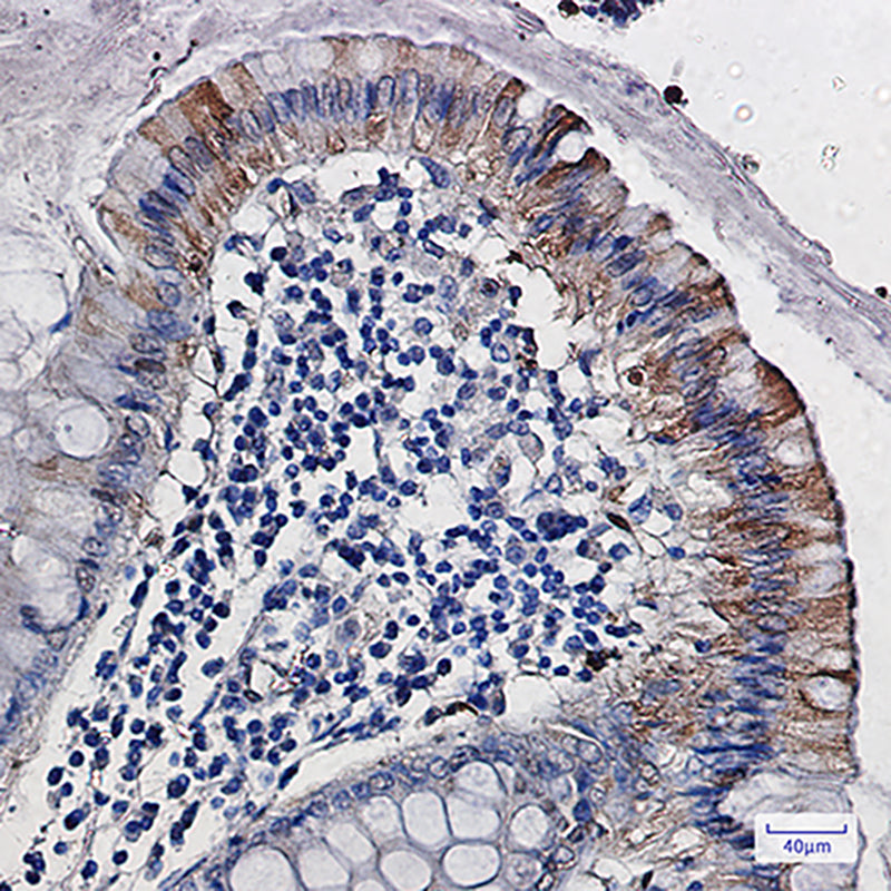 Anti-CDA Rabbit Monoclonal Antibody