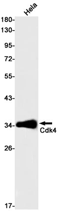 Anti-CDK4 Rabbit Monoclonal Antibody