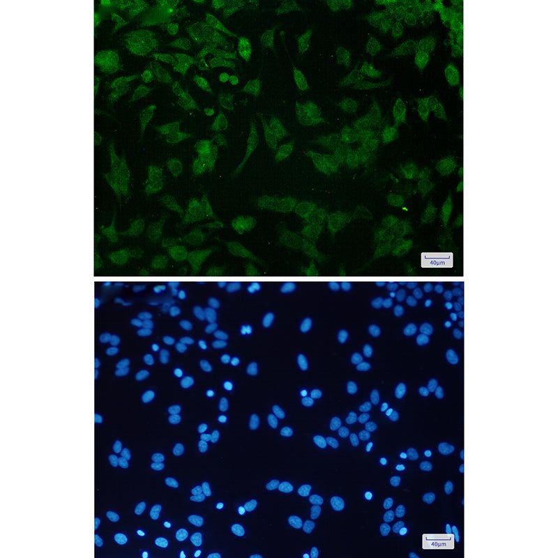 Anti-CDKN2A/p16INK4a Rabbit Monoclonal Antibody