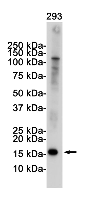 Anti-CDKN2A/p16INK4a Rabbit Monoclonal Antibody