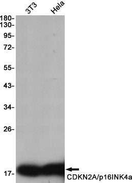 Anti-CDKN2A/p16INK4a Rabbit Monoclonal Antibody
