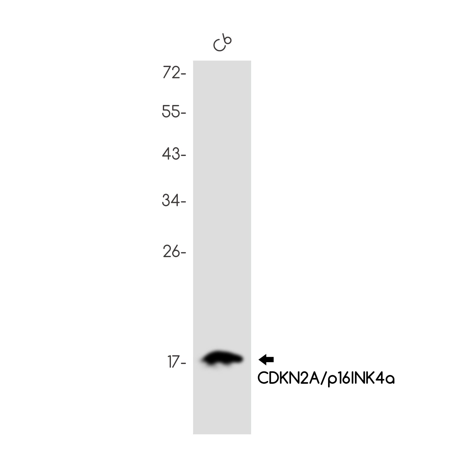 Anti-CDKN2A/p16INK4a Rabbit Monoclonal Antibody