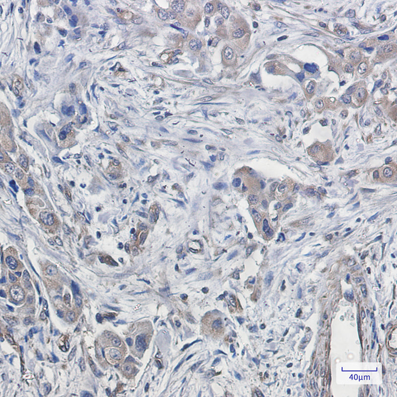 Anti-CDT2 Rabbit Monoclonal Antibody