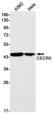 Anti-CECR5 Rabbit Monoclonal Antibody