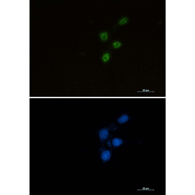 Anti-Chk2 Rabbit Monoclonal Antibody