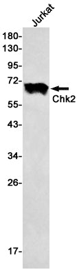 Anti-Chk2 Rabbit Monoclonal Antibody