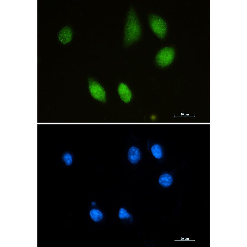 Anti-Choline Acetyltransferase Rabbit Monoclonal Antibody
