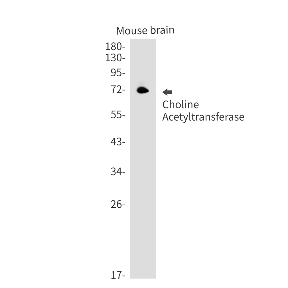 Anti-Choline Acetyltransferase Rabbit Monoclonal Antibody