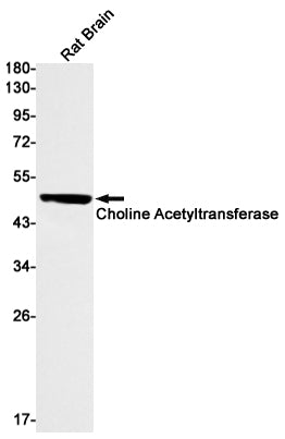 Anti-Choline Acetyltransferase Rabbit Monoclonal Antibody