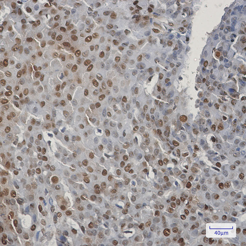 Anti-CIRBP Rabbit Monoclonal Antibody