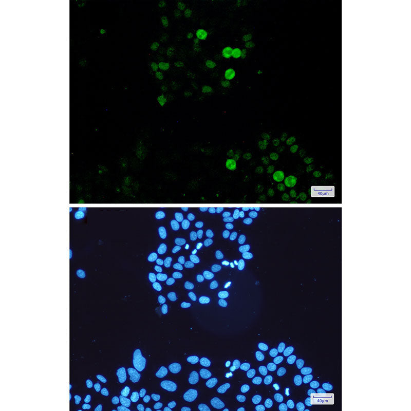 Anti-Phospho-c-Myc (Ser62) Rabbit Monoclonal Antibody