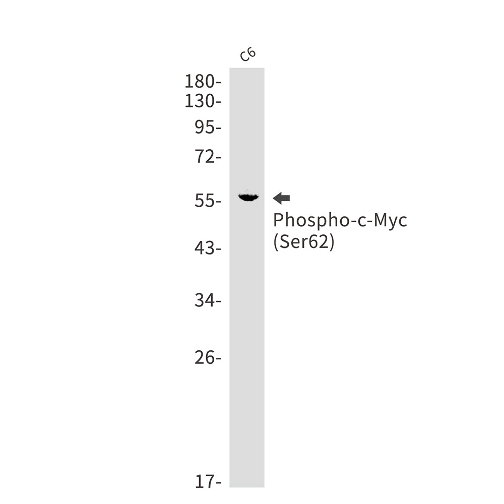 Anti-Phospho-c-Myc (Ser62) Rabbit Monoclonal Antibody